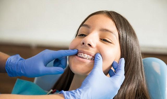 Ortodontik Tedaviler İçin 'Ergenlik' En İdeal Dönem Ortodontik Tedaviler İçin 'Ergenlik' En İdeal Dönem