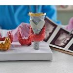 Yalancı Nodüller Gereksiz Tiroit Ameliyatlarına Yol Açabiliyor!